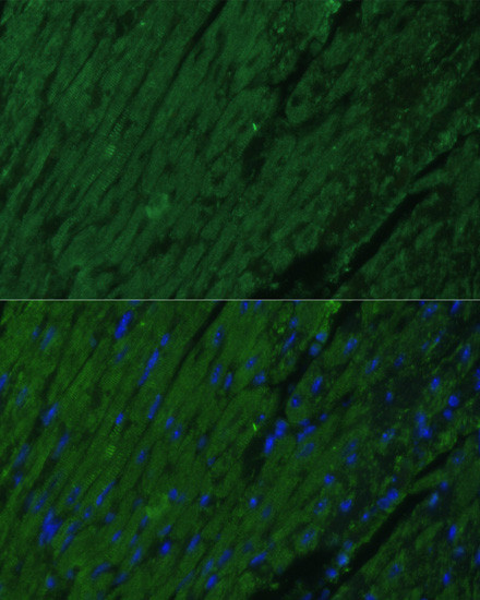 Cardiac Troponin I Antibody in Immunocytochemistry (ICC/IF)
