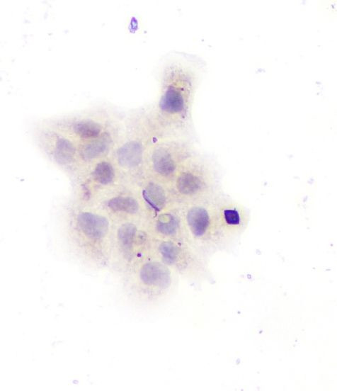 GAD67 Antibody in Immunocytochemistry (ICC/IF)