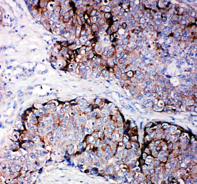TIMP2 Antibody in Immunohistochemistry (Paraffin) (IHC (P))