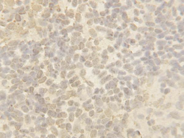 Cullin 4B Antibody in Immunohistochemistry (Paraffin) (IHC (P))