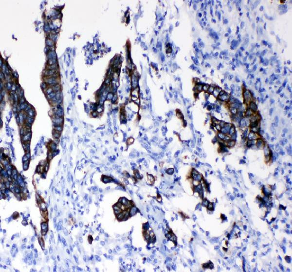 Cytokeratin 8 Antibody in Immunohistochemistry (Paraffin) (IHC (P))