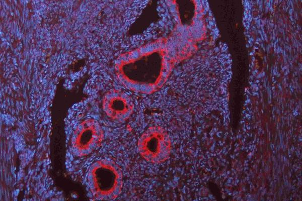N-cadherin Antibody in Immunohistochemistry (Paraffin) (IHC (P))