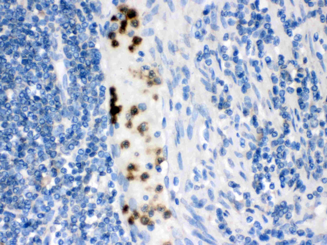 FABP3 Antibody in Immunohistochemistry (Paraffin) (IHC (P))