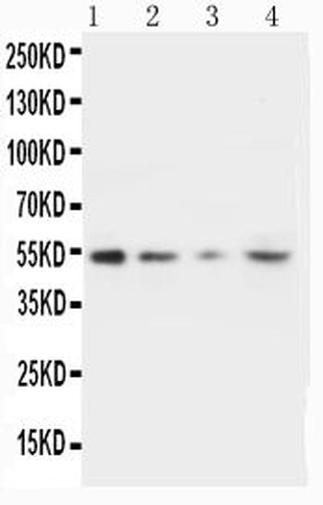 MMP10 Antibody in Western Blot (WB)