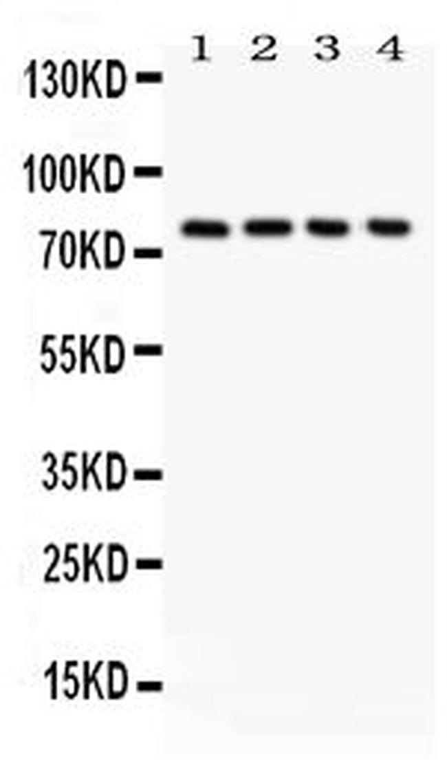 Tau Antibody in Western Blot (WB)