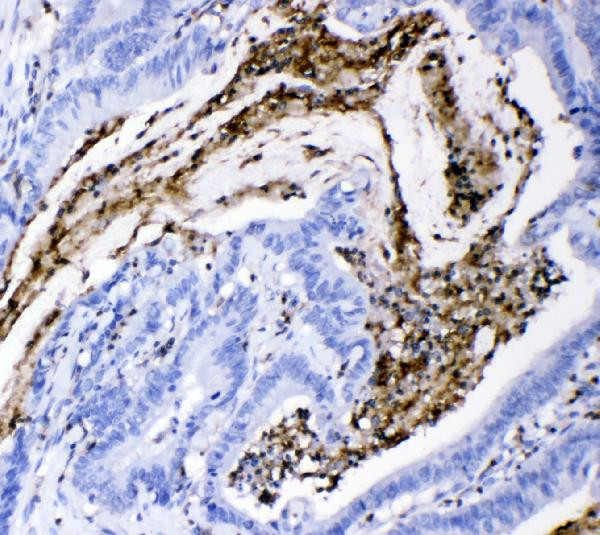 CD18 Antibody in Immunohistochemistry (Paraffin) (IHC (P))