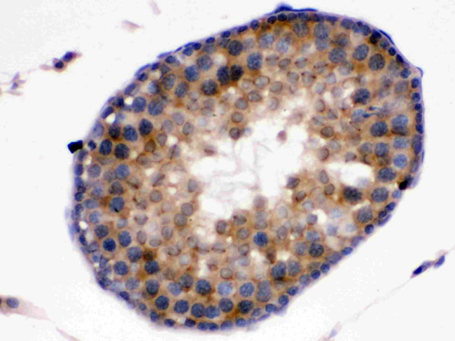 Kallikrein 5 Antibody in Immunohistochemistry (Paraffin) (IHC (P))
