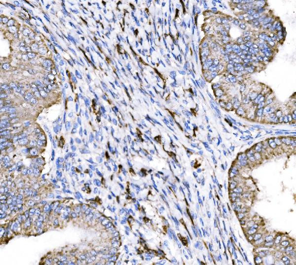 HTR1A Antibody in Immunohistochemistry (Paraffin) (IHC (P))