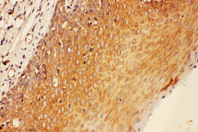 SOCS3 Antibody in Immunohistochemistry (Paraffin) (IHC (P))