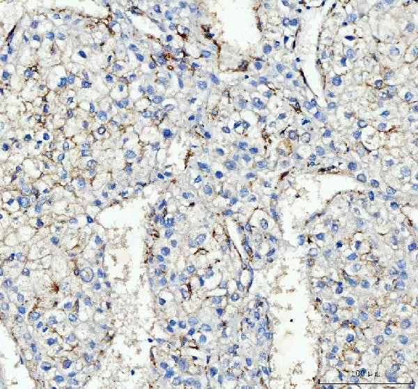 CD163 Antibody in Immunohistochemistry (Paraffin) (IHC (P))