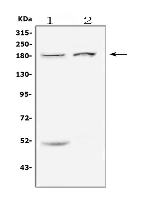 ErbB3 Antibody in Western Blot (WB)