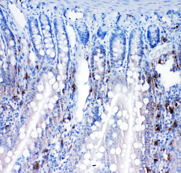TrxR2 Antibody in Immunohistochemistry (Paraffin) (IHC (P))