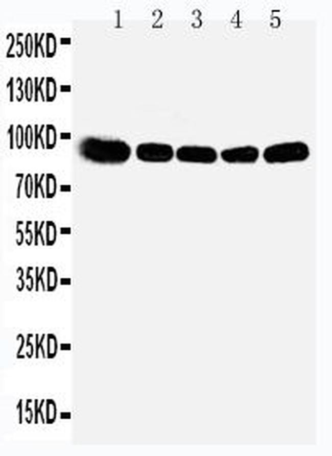 OSBP Antibody in Western Blot (WB)