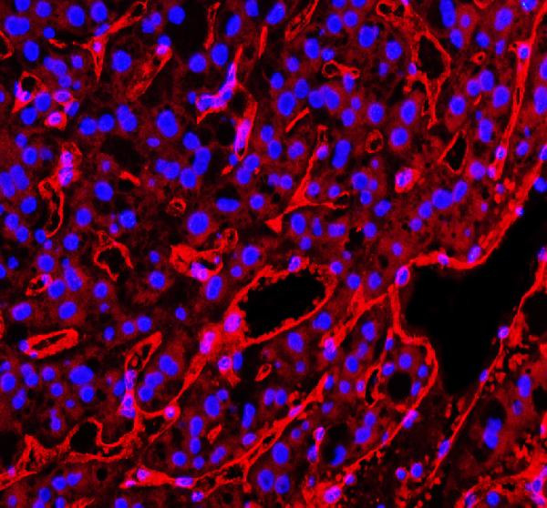CD31 Antibody in Immunohistochemistry (Paraffin) (IHC (P))