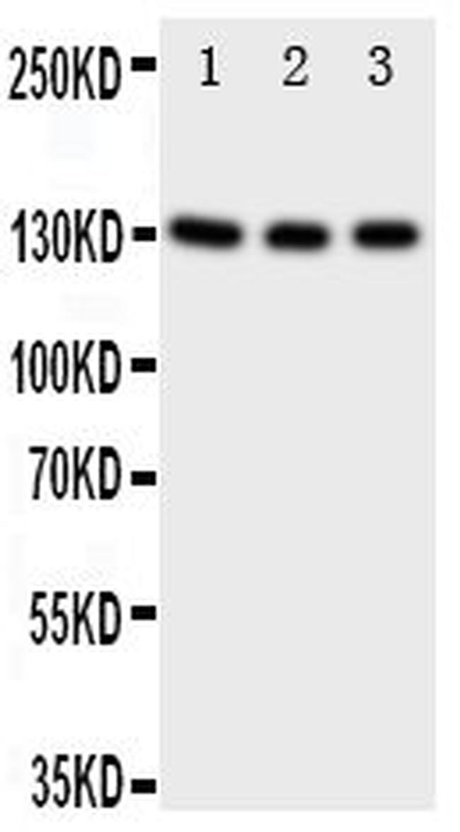 TrkC Antibody in Western Blot (WB)