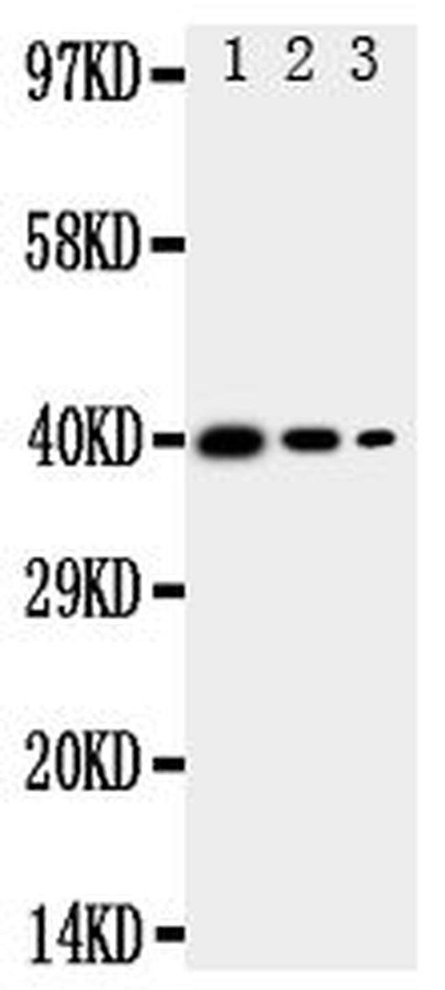 TRAM2 Antibody in Western Blot (WB)