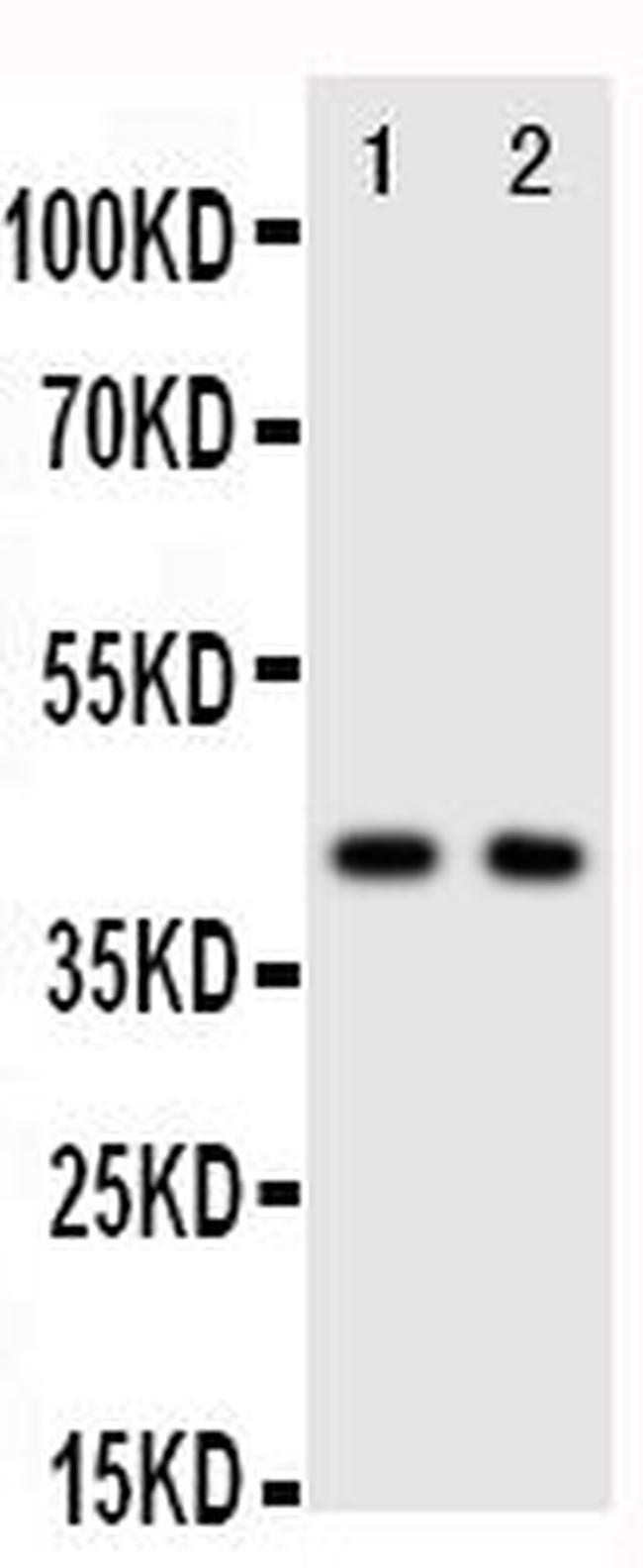 CXCR5 Antibody in Western Blot (WB)