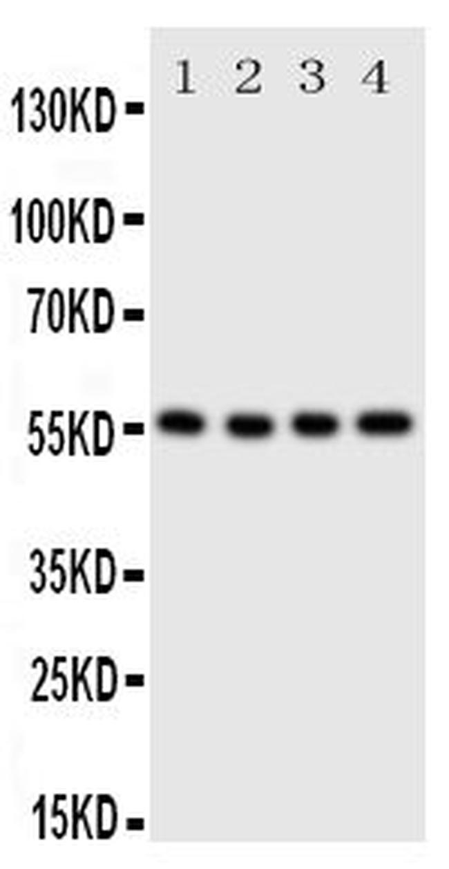 SLC2A5 Antibody in Western Blot (WB)
