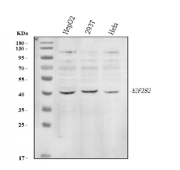 eIF2 beta Antibody in Western Blot (WB)