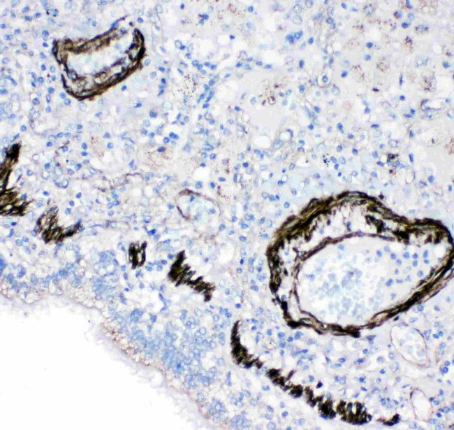 FABP6 Antibody in Immunohistochemistry (Paraffin) (IHC (P))