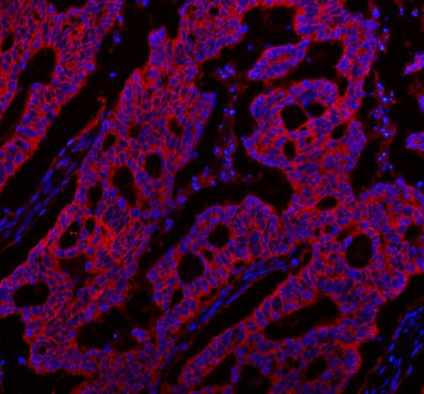 NKCC1 Antibody in Immunohistochemistry (Paraffin) (IHC (P))