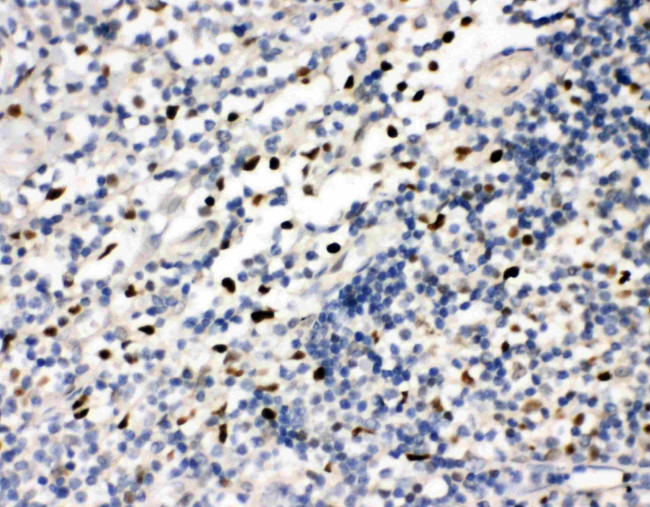 FLI1 Antibody in Immunohistochemistry (Paraffin) (IHC (P))