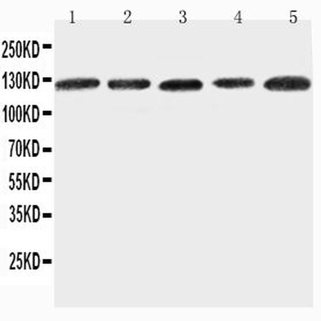 ITGA7 Antibody in Western Blot (WB)