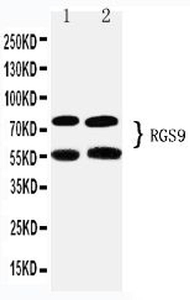 RGS9 Antibody in Western Blot (WB)