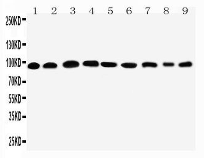 PKP2 Antibody in Western Blot (WB)