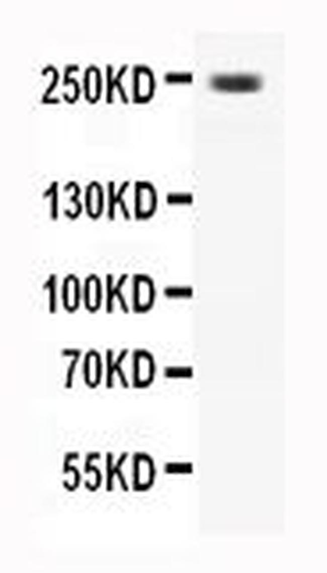 CaV1.3 Antibody in Western Blot (WB)