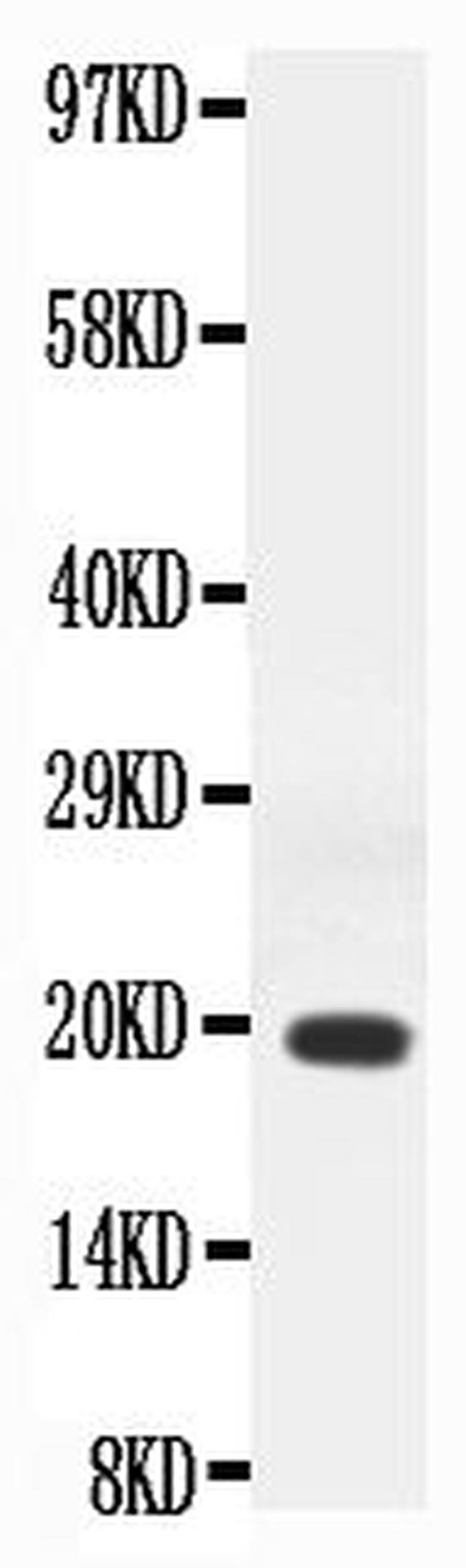 IFN gamma Antibody in Western Blot (WB)