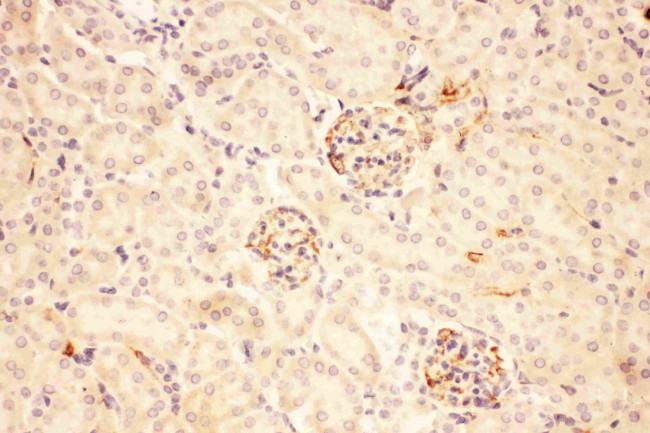 ACTH Antibody in Immunohistochemistry (Paraffin) (IHC (P))