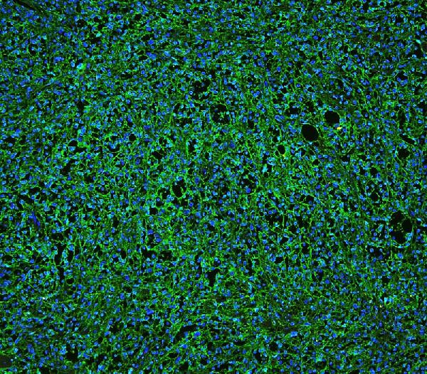 CD20 Antibody in Immunohistochemistry (Paraffin) (IHC (P))