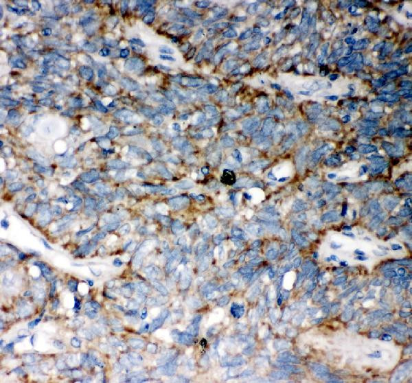 WNT5A Antibody in Immunohistochemistry (Paraffin) (IHC (P))