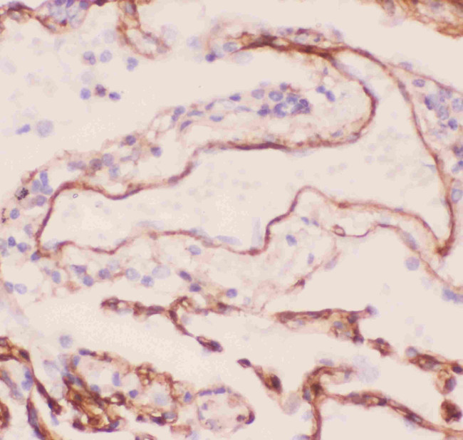 COL4A1 Antibody in Immunohistochemistry (Paraffin) (IHC (P))