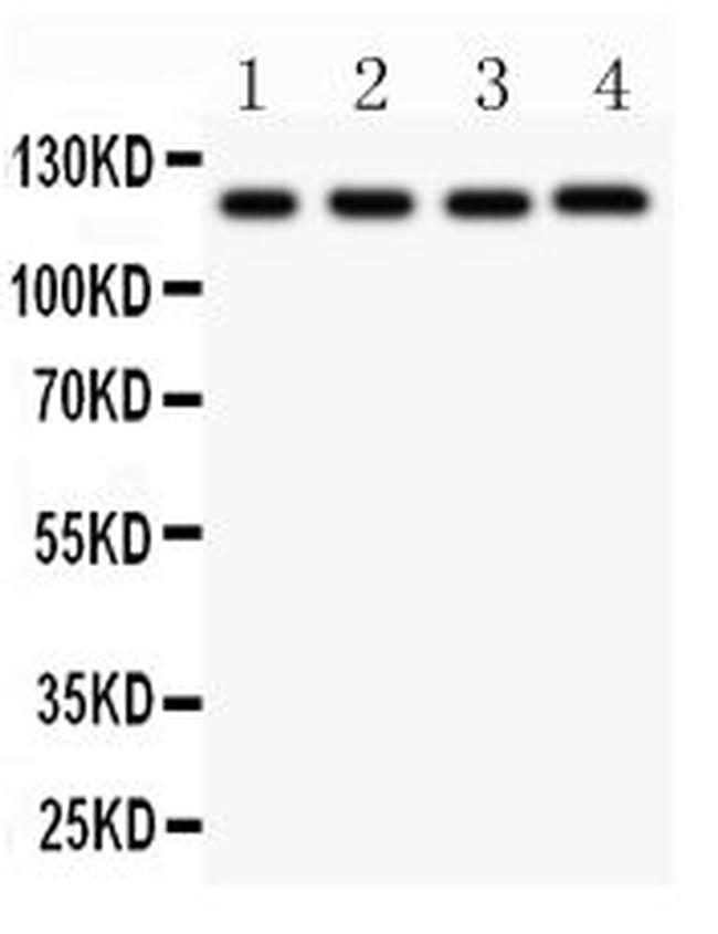 NLRP3 Antibody in Western Blot (WB)