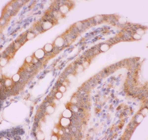 NFkB p52/p100 Antibody in Immunohistochemistry (Paraffin) (IHC (P))
