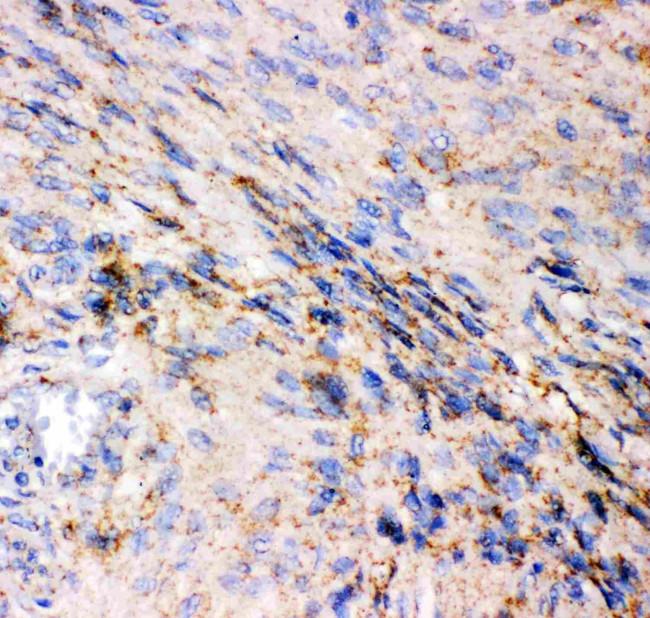 GluR1 Antibody in Immunohistochemistry (Paraffin) (IHC (P))