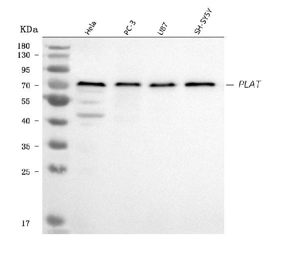 tPA Antibody in Western Blot (WB)