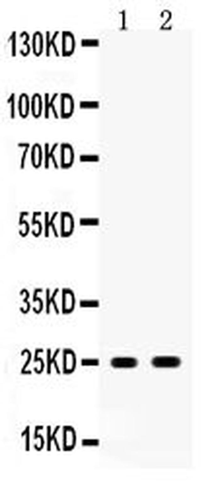 PSCA Antibody in Western Blot (WB)
