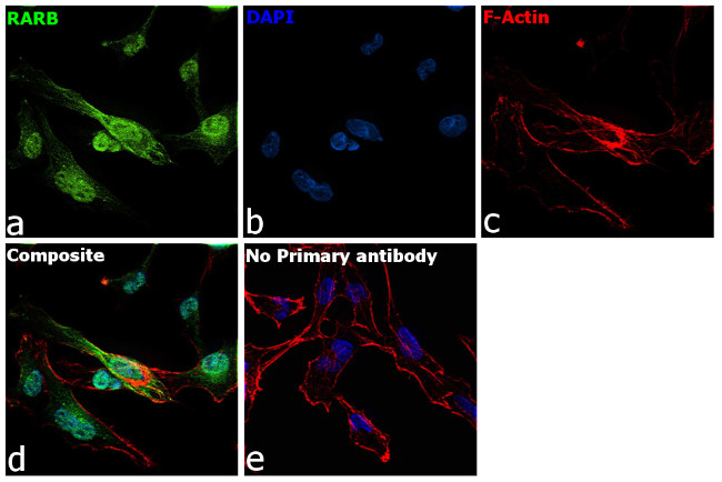 PTCH Antibody in Immunocytochemistry (ICC/IF)