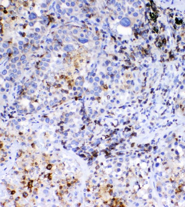 CD36 Antibody in Immunohistochemistry (Paraffin) (IHC (P))