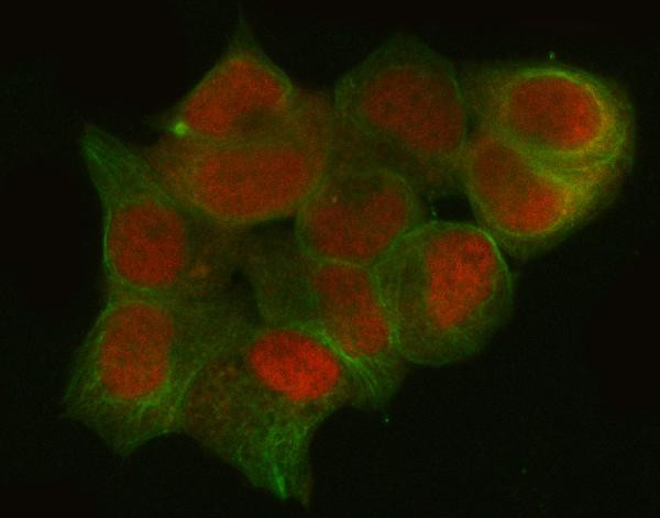 CtBP1 Antibody in Immunocytochemistry (ICC/IF)