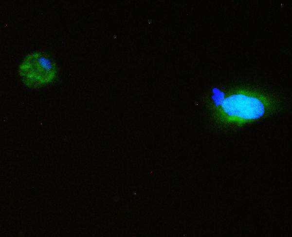 SQSTM1 Antibody in Immunocytochemistry (ICC/IF)