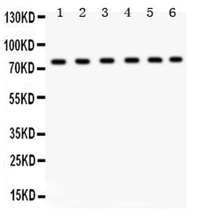 TRPV5 Antibody in Western Blot (WB)
