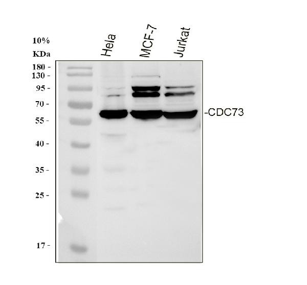 Cdc73 Antibody in Western Blot (WB)