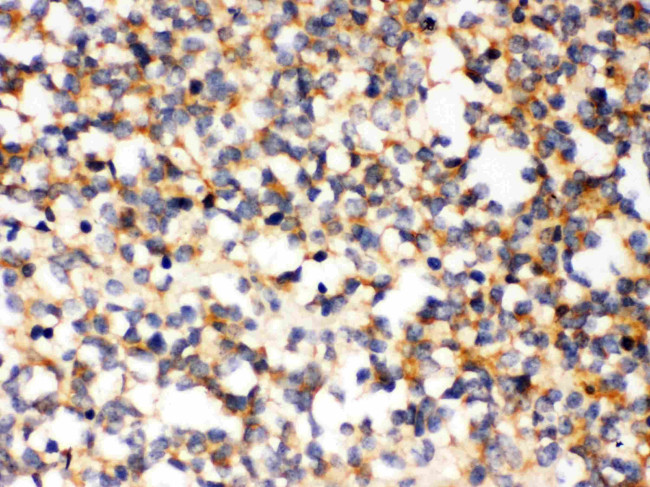 PAK7 Antibody in Immunohistochemistry (Paraffin) (IHC (P))