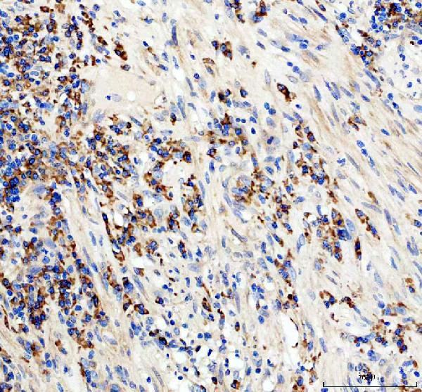 CD19 Antibody in Immunohistochemistry (Paraffin) (IHC (P))