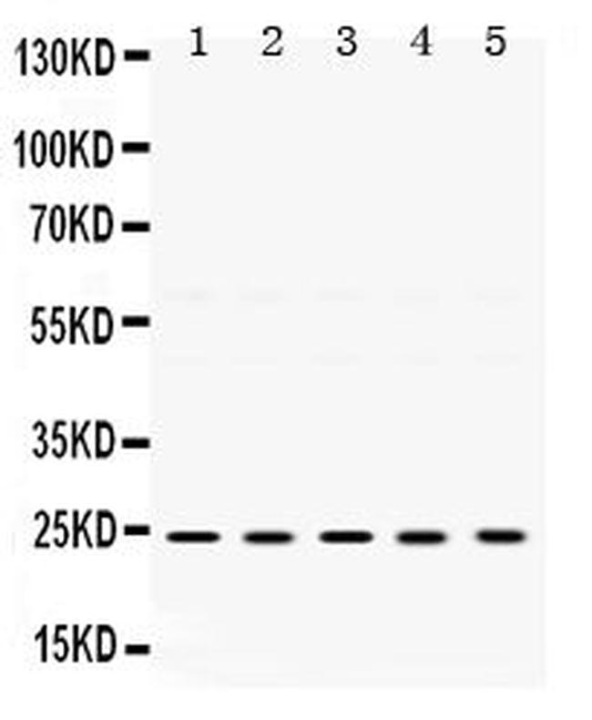 TIMP2 Antibody in Western Blot (WB)