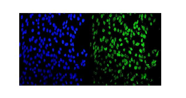 MEF2A Antibody in Immunocytochemistry (ICC/IF)